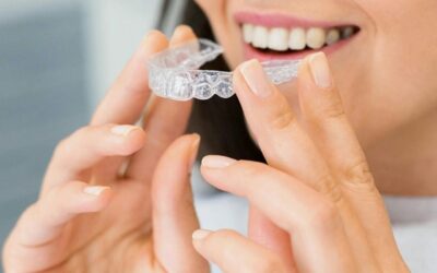 Orthodontie (aligners)
