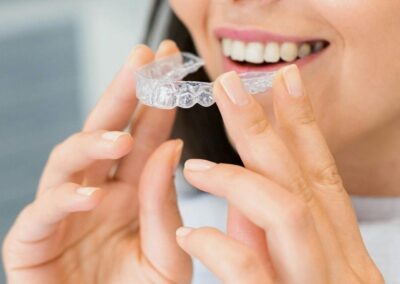Orthodontie (aligners)